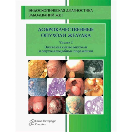 Доброкачественные опухоли желудка. Часть1: Эпителиальные опухоли и опухолеподобные поражения: Учебно-методическое