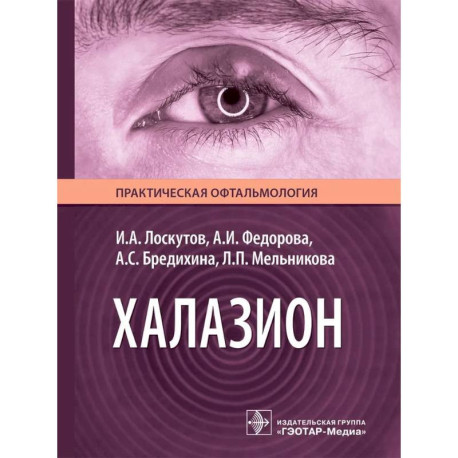 Халазион