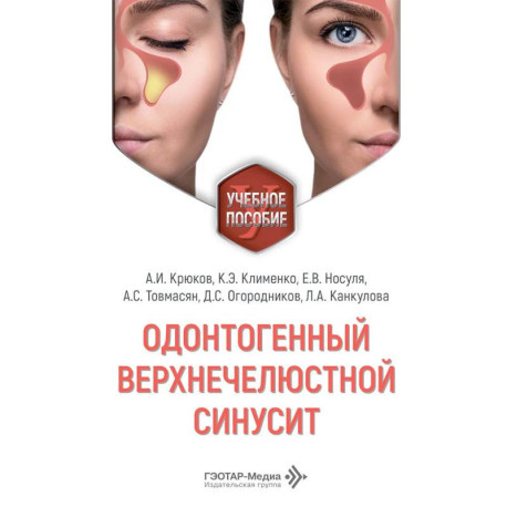 Одонтогенный верхнечелюстной синусит : учебное пособие
