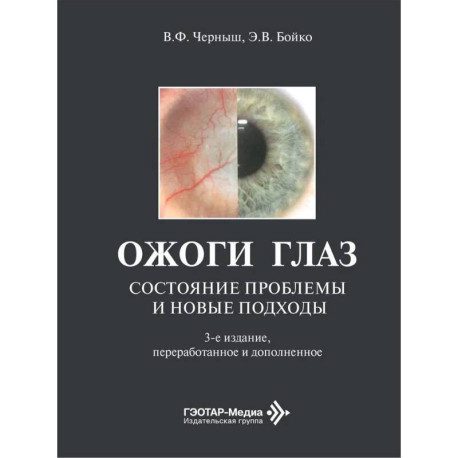 Ожоги глаз. Состояние проблемы и новые подходы