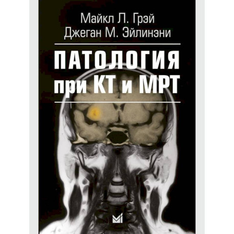 Патология при КТ и МРТ
