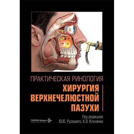 Практическая ринология:хирургия верхнечелюстной пазухи
