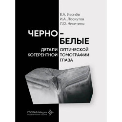 Черно-белые детали оптической когерентной томографии глаза