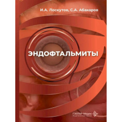 Эндофтальмиты: руководство для врачей