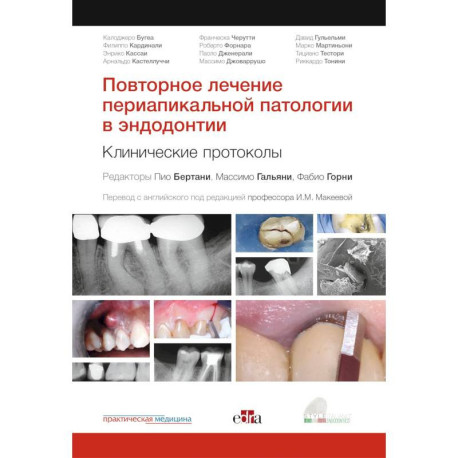 Повторное лечение периапикальной патологии в эндодонтии. Клинические протоколы