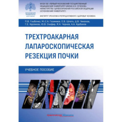 Трехтроакарная лапароскопическая резекция почки