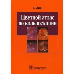 Цветной атлас по кольпоскопии.